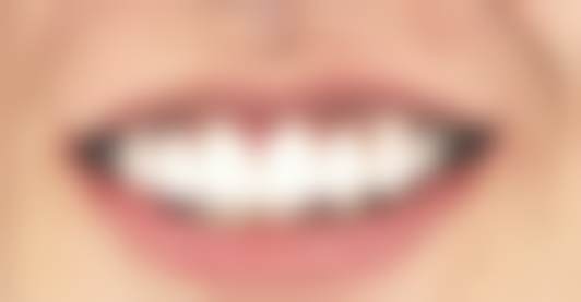 北京劲松口腔医院的口碑评价