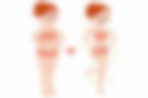 深圳美莱徐占锋抽脂绝绝子!揭秘抽脂项目价格与医生技术亮点