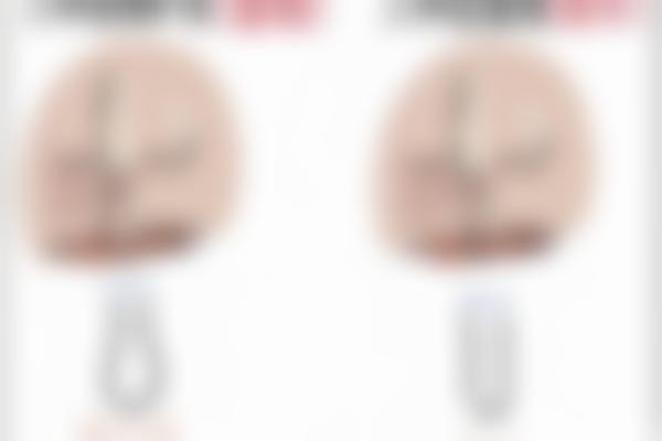 王晓健做人中缩短不用拆线吗?揭秘该项目价格、医生亮点,带你少踩坑!