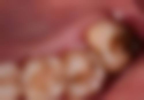 长沙美奥口腔医院收费贵吗？其实价格合理，服务和技术都在线，性价比挺高！ 