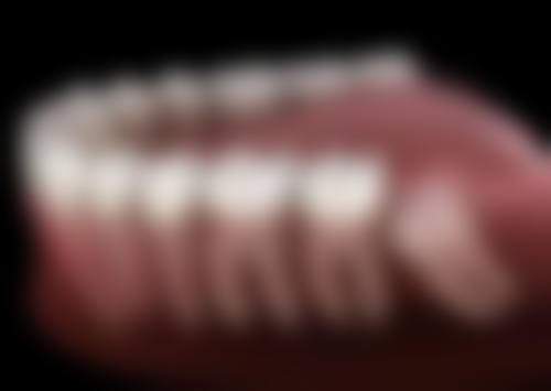 南充团圆口腔医院:贴心的服务与合理的价格