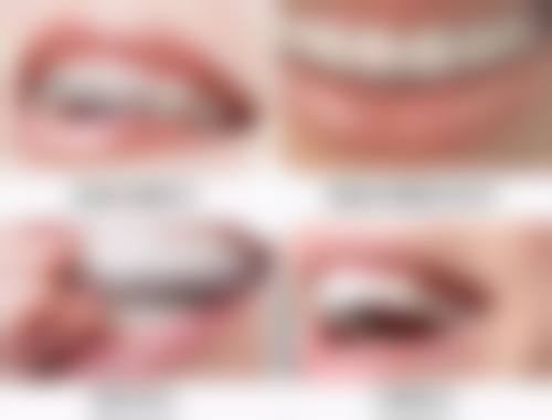 南充团圆口腔医院值得信赖吗？正规资质医生经验丰富，服务贴心是值得信赖的口腔医院 