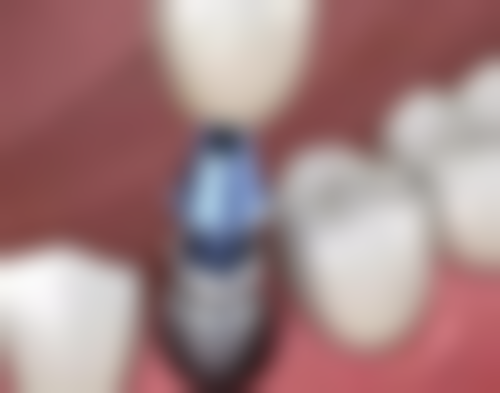 天津中诺口腔医院擅长项目:技术领跑,满足多样需求