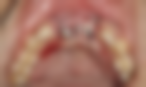 天津中诺口腔医院患者口碑:技术靠谱,服务贴心