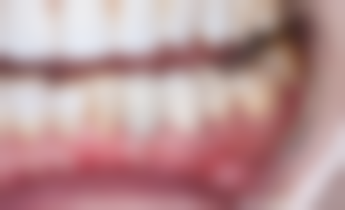 天津中诺口腔医院:价格公道透明,多种项目可选