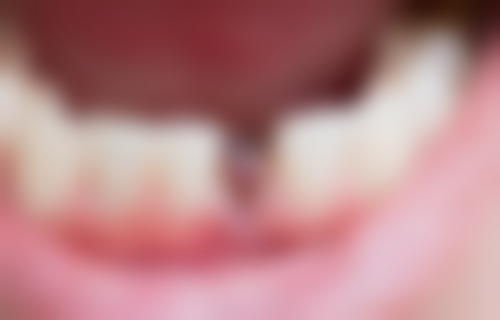 天津中诺口腔医院:专精医生团队实力强