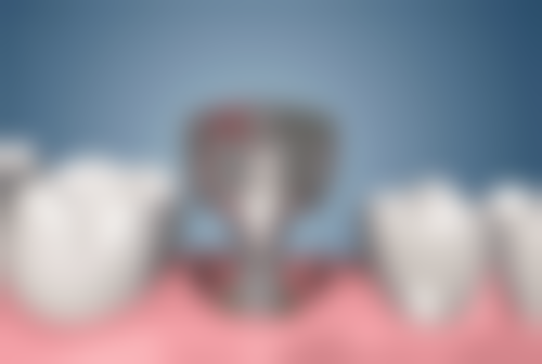 天津中诺口腔医院坑不坑?患者亲述体验,正规靠谱技术好,服务贴心不踩雷