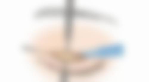 成都新桥口腔医院:患者口碑良好,满意度高