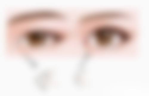 成都新桥口腔医院值得信赖吗?专业医生团队、先进设备,做医美项目靠谱有保障!