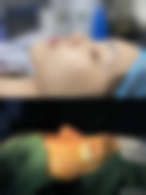 大连芳华整形美容医院肋软骨鼻综合价格参考