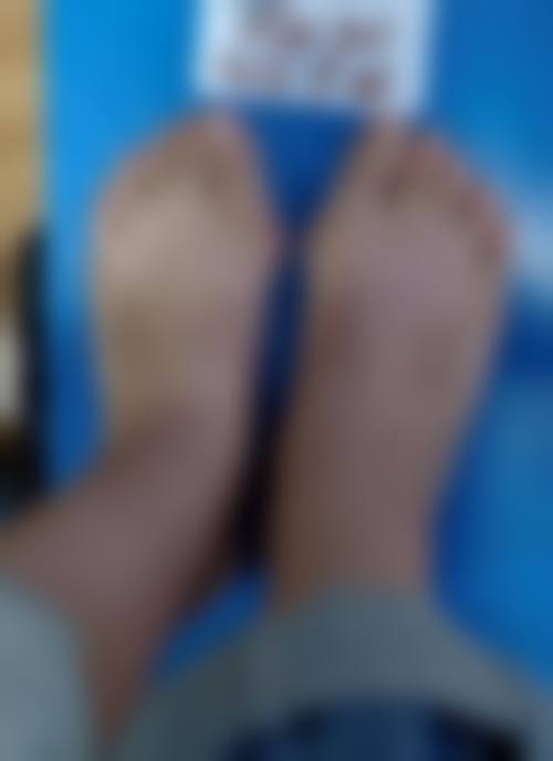 北京圣嘉新拇外翻整形医院:精良的医疗设备