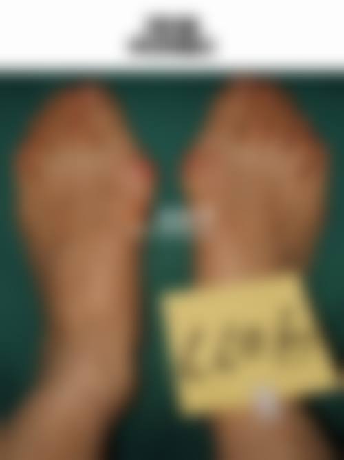 北京圣嘉新拇外翻整形医院正规吗?正规靠谱资质齐全,医生技术好效果有保障