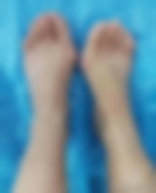 北京圣嘉新拇外翻整形医院:优质的服务体验