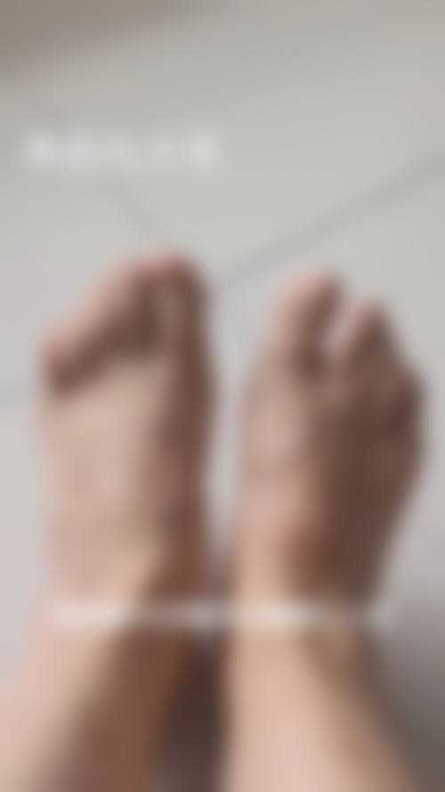 北京圣嘉新拇外翻整形医院:技术不错的医生团队