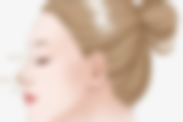 济南艺星卢建做隆鼻技术咋样啊?他做隆鼻技术挺靠谱,鼻子形态自然好看