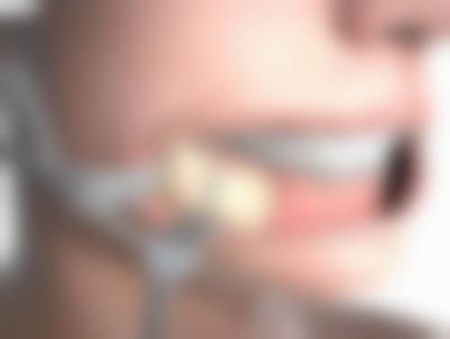 南充医大口腔门诊部:网友口碑评价