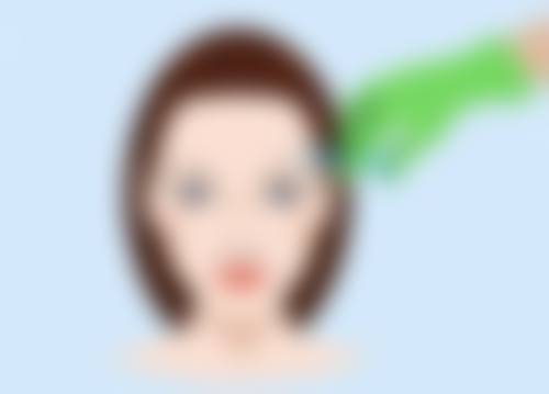 重庆军美医疗美容医院朱芯医生玻尿酸注射优势及价格