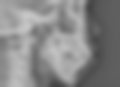 北京黄寺整形外科医院吸脂塑形与胸部整形价格一览