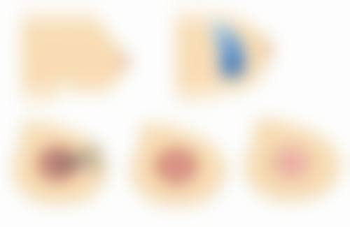 重庆军美医疗美容医院消费者真实评价怎么样?口碑有见证