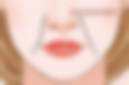 北京黄寺整形外科医院杜太超医生的拉皮技术亮点