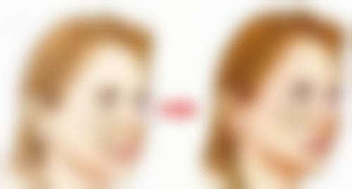 北京黄寺整形外科医院杜太超坐诊时间都在这,想找他做医美项目的朋友别错过了解机会!