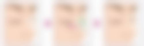 达州医大口腔医院补牙与根管治疗项目价格