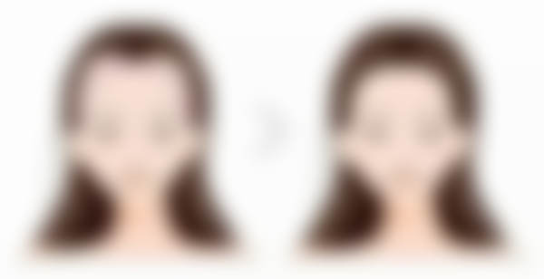 碧莲盛和大麦哪个技术好?从医生团队和案例效果为你分析,看完心中有数!