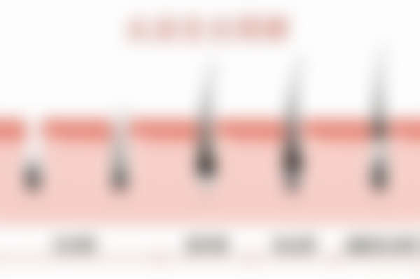 雍禾和碧莲盛哪个效果好?从技术、案例全面对比,让你清晰选对植发机构!