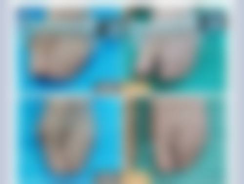 广州高尚医学美容中 心的收费与服务情况