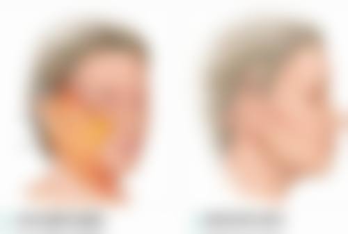 北京海德堡口腔医院是公立的吗?实则是私立口腔医院，医生技术好设备先进值得选 