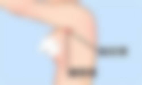 北京海德堡口腔医院的精良技术与特色诊疗