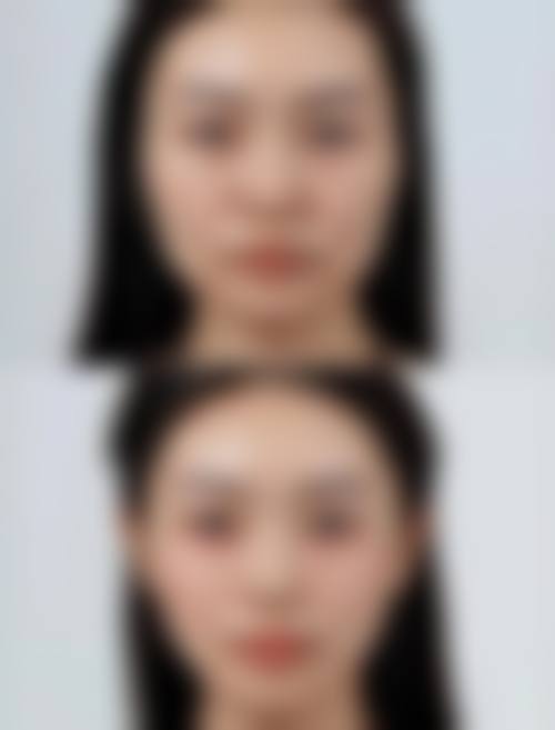 罗恩医生的号什么时候放?专业揭秘放号时间,助你轻松预约医美诊疗!