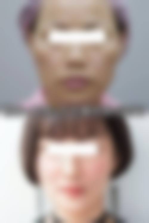 华 西医院罗恩医生手术安排时间