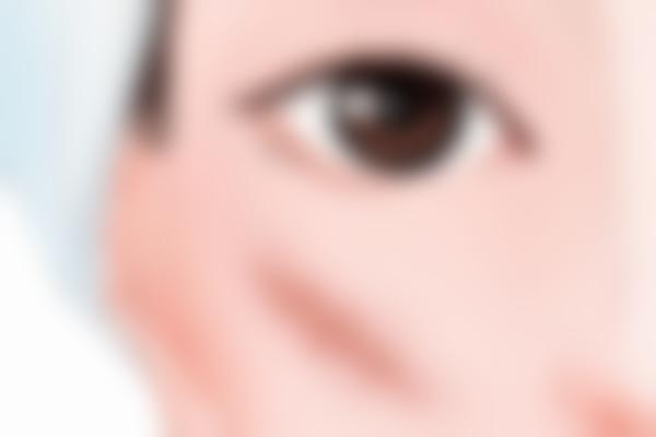 广州曙光疤痕修复中心怎么样？技术口碑都在线修复很安心