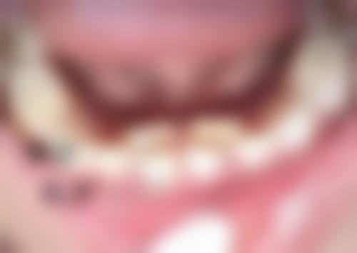 西安画美整形医院价格表来啦！涵盖多种热门医美项目，让你清楚消费不花冤枉钱 