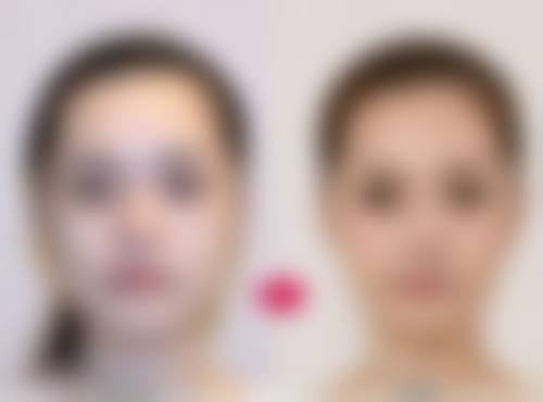 深圳阳光整形医院的交通指南及营业时间