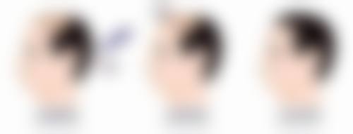 南京康美医疗美容医院的收费情况如何？