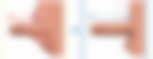 深圳阳光整形医院的优势及特色