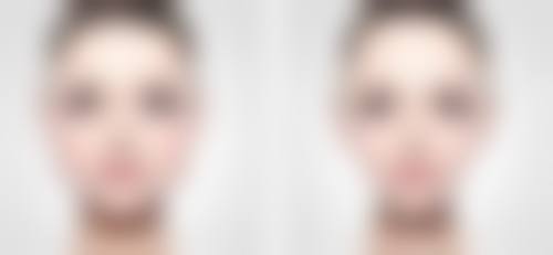 南京康美医疗美容医院胸部整形收费标准