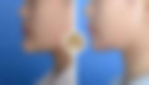 成都西区整形医院：正规之选，美丽保护