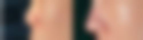 郑州辰星医疗美容医院何清磊医生预约挂号方法