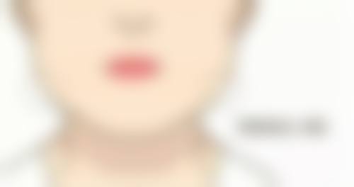 乌鲁木齐美奥口腔医院的收费亲民吗?