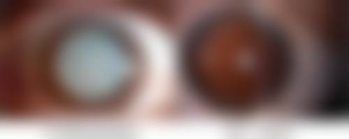 黑龙江哈尔滨瑞丽整形医院口碑好不好？正规靠谱技术优，顾客满意度高值得信赖！ 