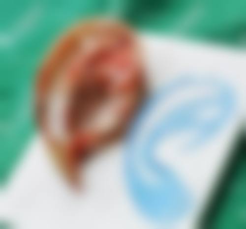 成都陈再洪医生业内口碑