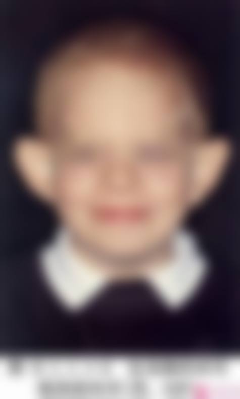 陈再洪医生做耳朵多少钱？业内口碑好技术优，价格有竞争力值得了解 