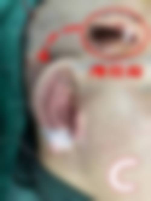 成都陈再洪医生技术优势