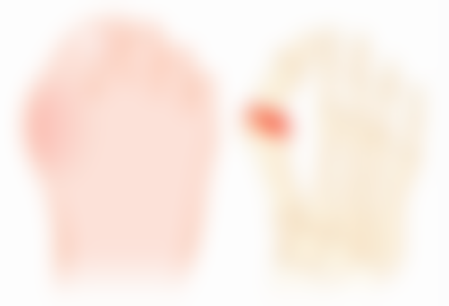 温州青禾植发医院植发项目价格表