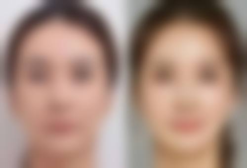 上海愉悦薇莱医疗美容医院坑不坑？听听做过项目的顾客怎么说，给你真实参考！ 