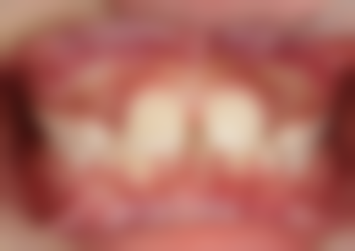 台州艺星医疗美容医院收费标准咋样？告诉你价格合理且项目丰富，性价比超高！ 