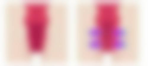 拉萨爱思特医疗美容医院：医生团队与收费标准